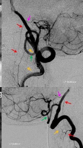 MEDULLARY