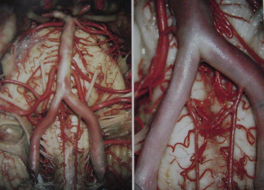 ANTERIOR