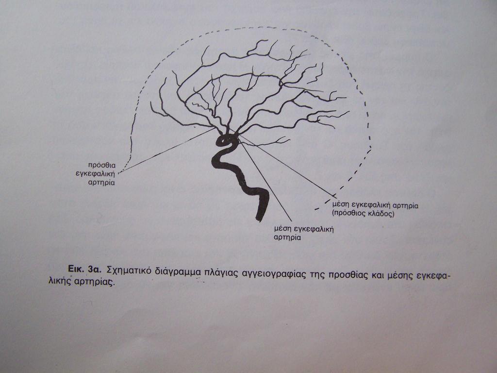 και αµέσως δίνει την πρόσθια χοριοειδή και την οπίσθια αναστοµωτική αρτηρία.