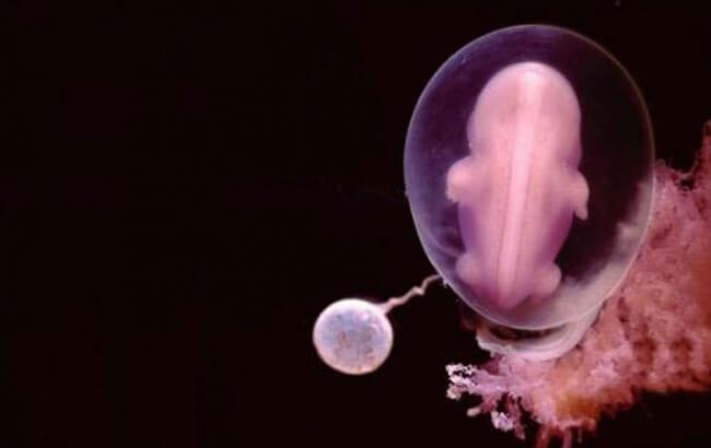 Lennart Nilsson (1922-2017) Έμβρυο 38 Ημερών Το έμβρυο σχεδόν 6 εβδομάδες μετά την γονιμοποίηση Έχουν σχηματιστεί οι αμνιακές
