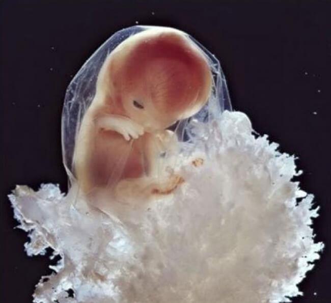 Lennart Nilsson (1922-2017) Έμβρυο 10-11 εβδομάδων Τα νύχια αναπτύσσονται Τα έξω γεννητικά όργανα εξελίσσονται σε