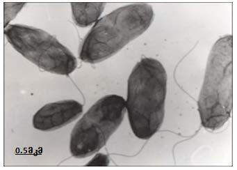 cholerae-s vibrionebi moxrili Cxiris formisaa, zomit, sigrzesi daaxloebit 1-1,5 mkm-ia, xolo siganesi 0,4-0,8 mkm.