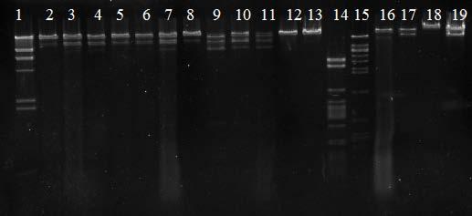 sur.43. EcoR V fermentit dawrili V. cholerae-s mimart specifikuri fagebis restriqciuli profili 1. λ -DNA+Hind III 2. Vch16K-O1 3. Vch16K-4805 4. Vch20K-O1 5.