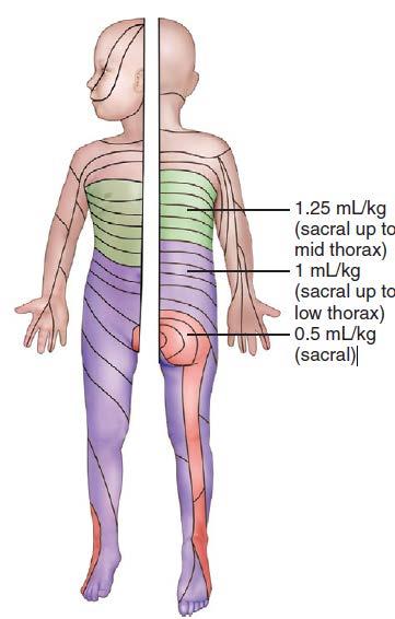 Dermatoma distribution of different volumes