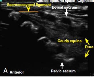 Caudal