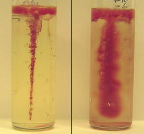 έλυτρο Urease test