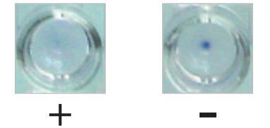 Anti-human immunoglobulins Antibodies in serum Antigen: stained B.