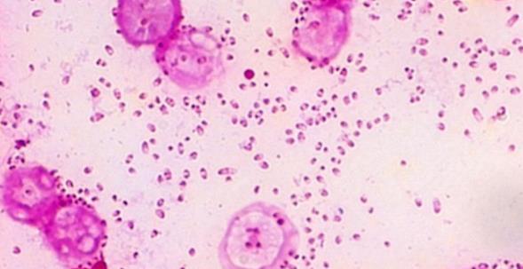 Pasteurella Gram (-), αερόβιο, δυνητικώς ενδοκυττάριο βακτήριο Τάξη: