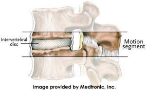 Ο μεσοσπονδύλιος δίσκος Δουλεύει ως αμορτισέρ απορροφώντας τους κραδασμούς