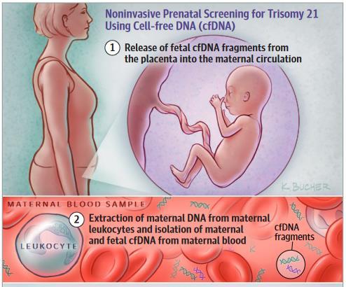 com/s/513691/prenatal-dna-sequencing/ Xρωμοσωμικές ανωμαλίες