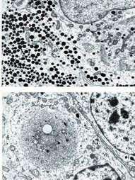 Χαρακτηριστικοί επιμέρους Κυττάρου και ορμόνης που παράγει Ki67