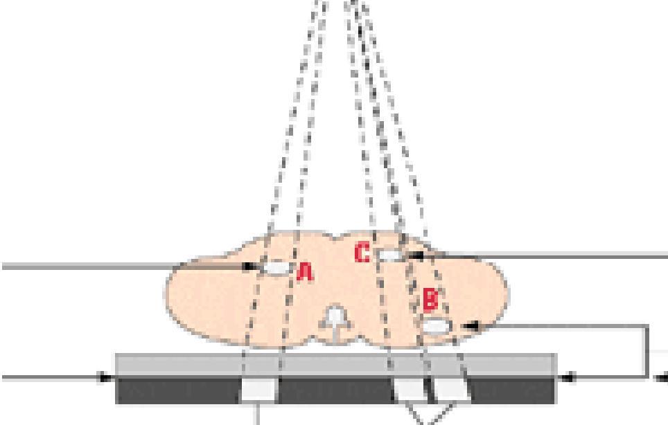 απόσταση OID θα επηρεάσει τη μεγέθυνση OID,