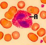 2. Ηωσινόφιλα * 1-4% των λευκών * Επιτίθενται
