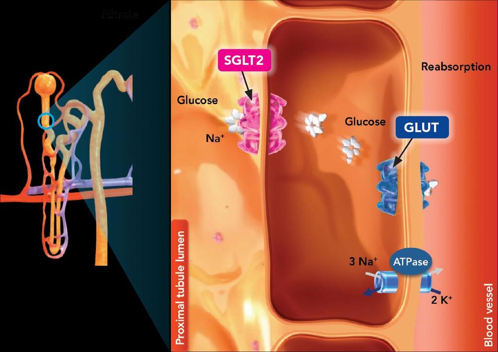 Proximal tubule lumen Blood vessel SGLTs: μεμβρανικές πρωτεϊνες που ρυθμίζουν τη