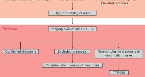 exertion or emotional strss prior to onset Diagnosis may be more difficult Young < 40 years (not