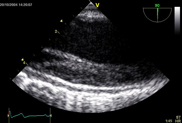on CT TOE: typical image density