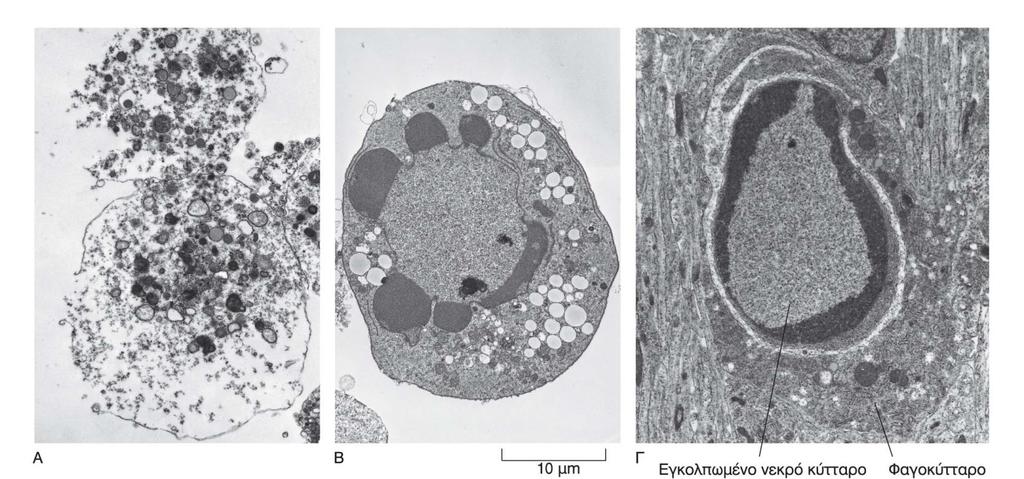 Διαφορετικοί τύποι κυτταρικού θανάτου Νέκρωση Απόπτωση Αυτοφαγία Σε αντίθεση με τη νέκρωση κατά την οποία τα κύτταρα διασπείρουν το