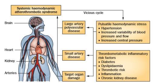 ΠΑΘΟΦΥΣΙΟΛΟΓΙΑ Συστηματικό αιμοδυναμικό αθηροθρομβωτικό σύνδρομο (Systemic haemodynamic atherothrombotic syndrome-shats):