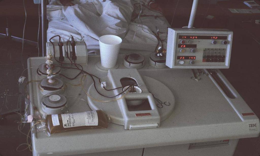 UCSD, 1983 PLASMA REMOVAL WITH RETURN OF CORPUSCLES