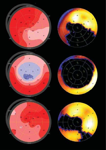 Global longitudinal strain by speckle tracking for infarct size estimation 227ασθενείς με STEMI Echo day 1, 30 MCE day 30 S