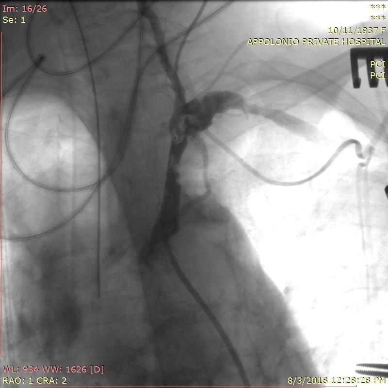 Dissection of