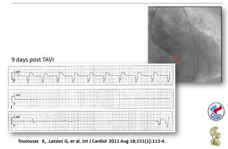 ECG (PM) Coro Angio Echo Diagnosis Other data