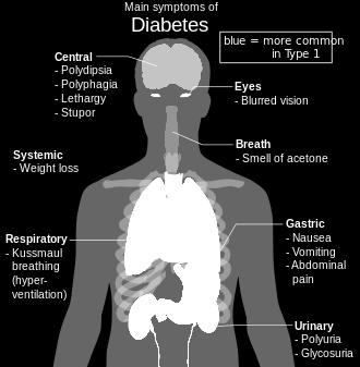 Symptoms