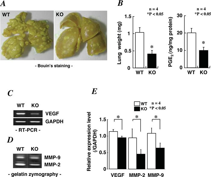 mpges-1 and tumorigenesis 369 Figure 6 Reduced lung metastasis in mpges-1-ko mice A total of 10 5 cells were injected into the lateral tail veins of female mpges-1-ko and WT mice on the BALB/c