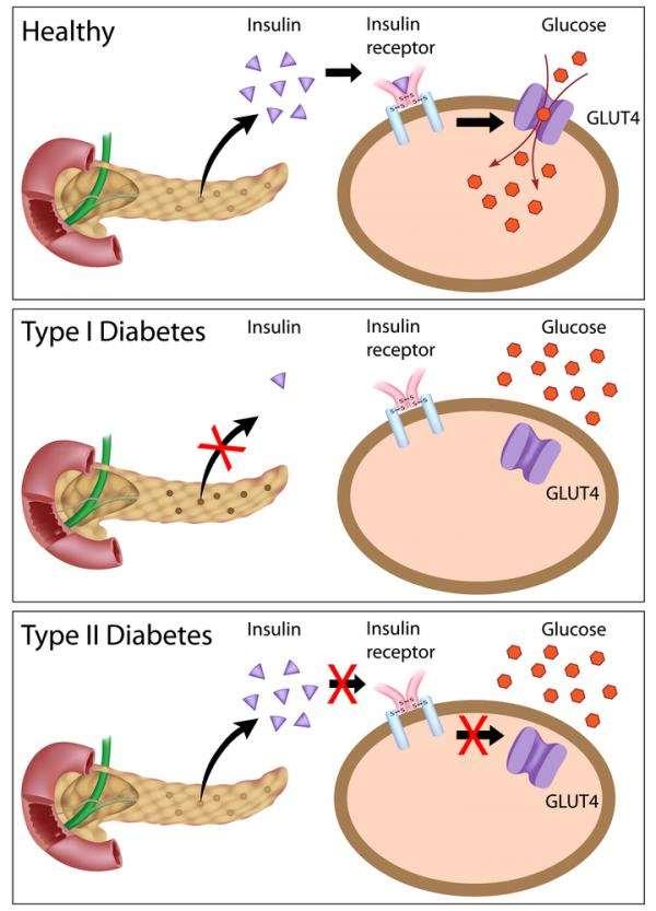 Insulin insufficiency Absolute 1. Genetic disorders 2. Autoimmune damaging of β- cells 3.