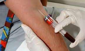 Criteria for the Diagnosis of Diabetes Fasting plasma glucose (FPG) 126 mg/dl (7.
