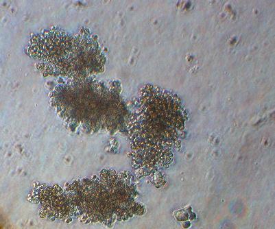 Αρχέγονα-Στελεχιαία-Πλειοδύναμα Αιμοποιητικά κύτταρα