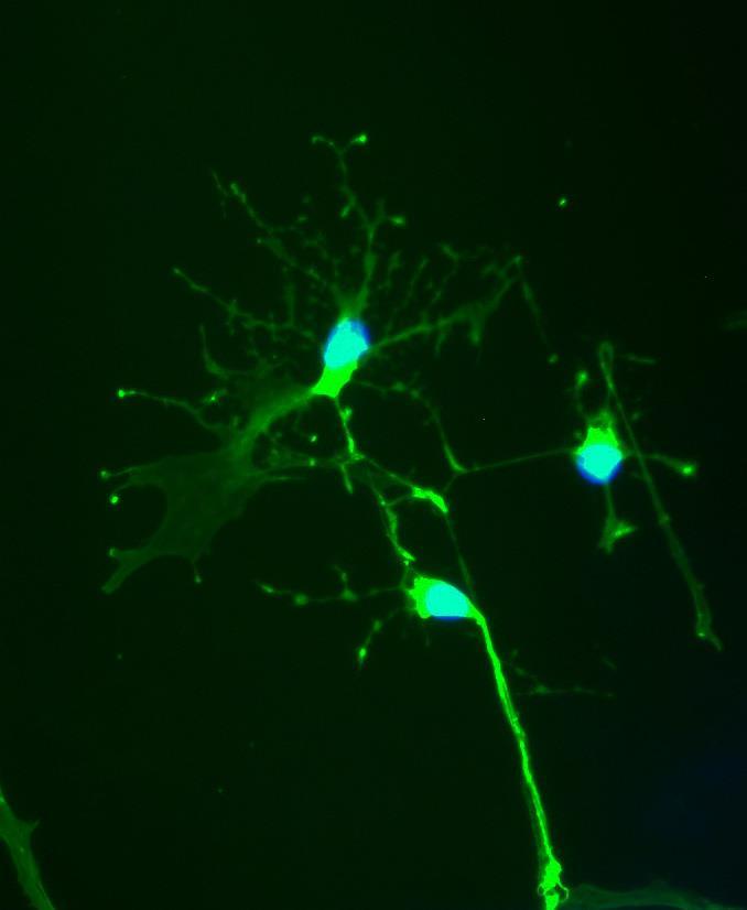 Νευρικά βλαστοκύτταρα που
