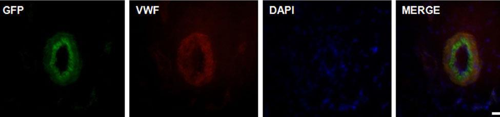 H GFP παράγεται από τα μεσεγχυματικά βλαστοκύτταρα του λιπώδους ιστού και ο σχηματισμός που παράγει μεταφέρεται επάνω