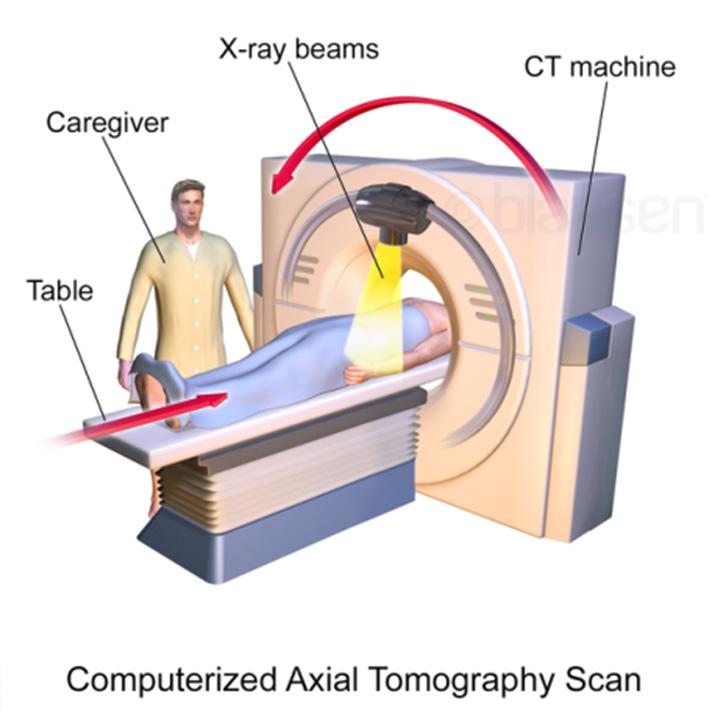Απεικονιστικά συστήματα CT Head CT