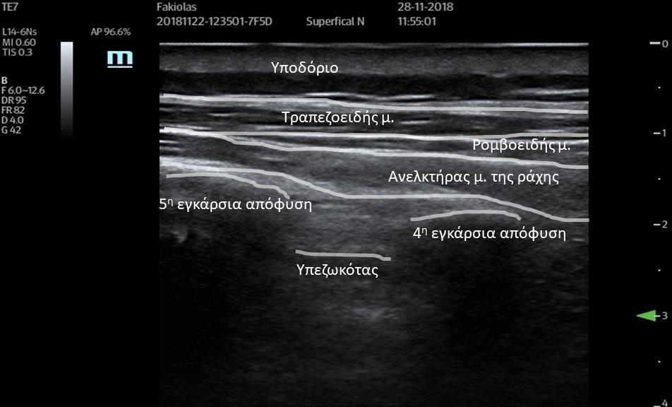 μέχρι το Θ 5 -Θ 6.