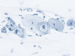 PAMPs Danger Model associated molecular patterns) Infectious Non-self Model,1989 Charles Janeway (Pathogen DAMPs (Damage associated molecular patterns) Νoninfectious inflammatory
