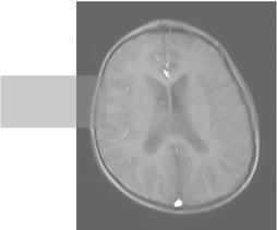 Αξονική (axial) ή εγκάρσια (transverse) τομή.