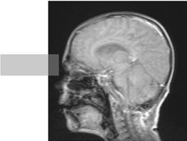 Οβελιαία (Sagittal) τομή.