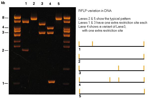 PCR -