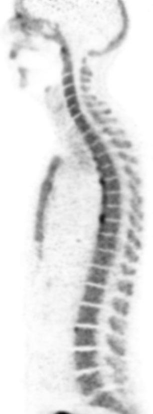 Tesla MRI T1 sequence 18F PET