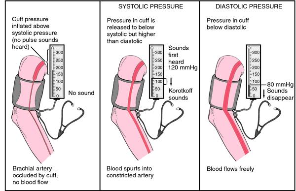 Auscultation method : 1- Feel the pulse of the brachial artery just medial to the biceps tendon in the cubital fossa.
