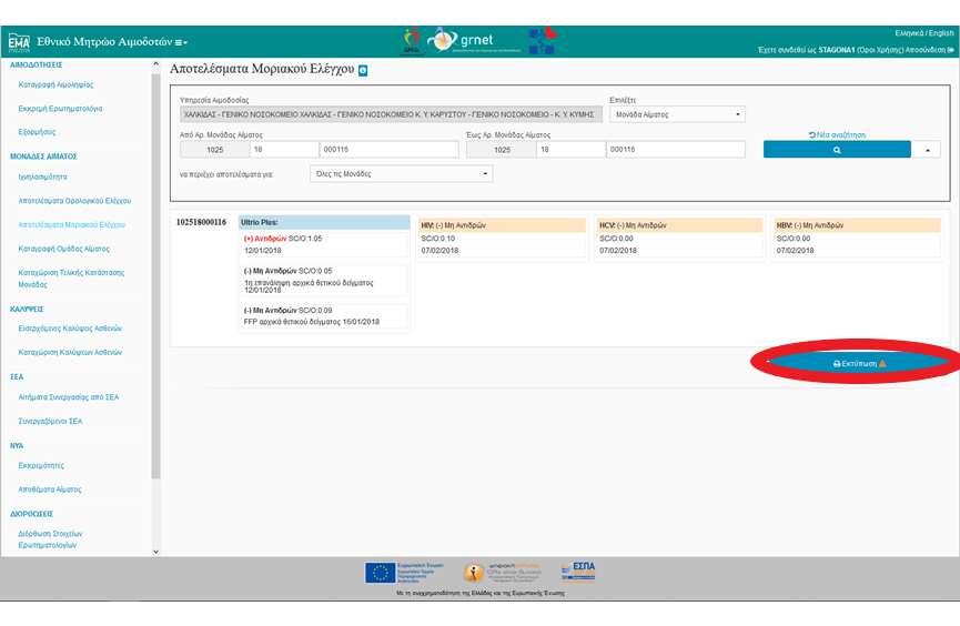 Εγχειρίδιο Χρηστών Υπηρεσίας Αιμοδοσίας Σελ. 82 Εικόνα 79: Εκτύπωση Αποτελεσμάτων 5.