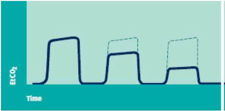 Time Capnography EtCO2: Μεταβολισμός, Αιμάτωση,