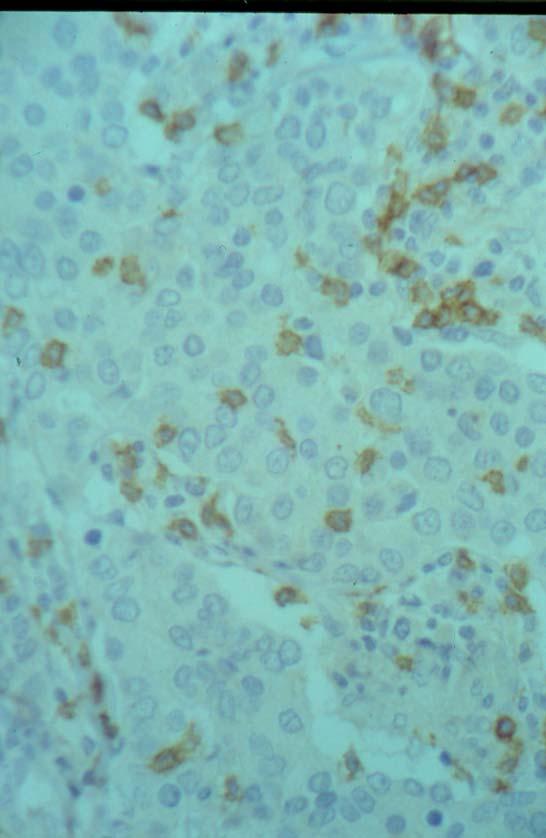 Τ8 λεμφοκύτταρα