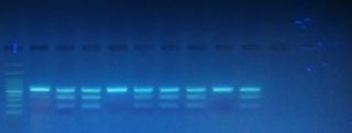 3.Β. rs9483947 (T>C) Η ύ ω ά ω ω rs9483947 φ θ ά ά PvuII-HF. Α ά, θ ω ά ω DNA ά ω PCR ύθ ά ω PCR ϊ ω ά PvuII-HF, φ ά ω ά. Τ, ύθ φ ω ϊ ω ά ω ζ 2%.