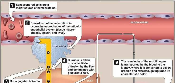 Χολερυθρίνη απεκκρίνεται µε την χολή στο έντερο Με ενζυµική δράση των βακτηριδίων µετατρέπεται σε
