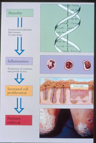 Παθοφυσιολογία της Ψωρίασης Κληρονομικότητα Γενετικά Καθοριζόμενη ανοσολογική Δερματοπάθεια Κινητοποιούμενη από περιβαλλοντικούς παράγοντες