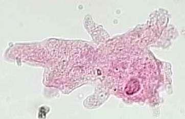 1. Amoeba proteus Αμοιβάδα Οι, Αμοιβάδες ζουν στα γλυκά νερά, στη θάλασσα, στο υγρό έδαφος και ακόμα σαν παράσιτα σε διάφορα ζώα και στον άνθρωπο.