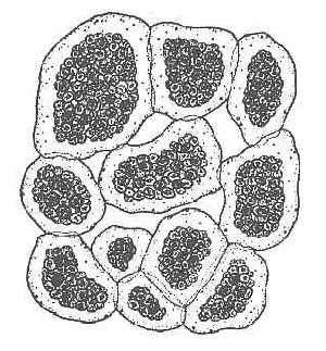 23. Μικροκύστη - Microcystis Γένος Κυανοφυκών που ανήκει στην τάξη Χρωοκοκκώδη.