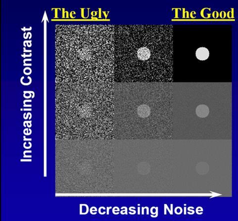 Στο Σχ. 27 φαίνεται η επίδραση της αντίθεσης και του θορύβου στην ποιότητα της εικόνας. Σχ. 27: Η αύξηση της αντίθεσης και η μείωση του θορύβου οδηγούν στην βέλτιστη εικόνα.